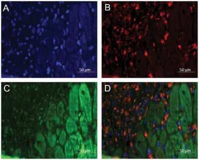 Immunohistochemistry: Renin R Antibody [NB100-1318] - Immunofluorescence staining of LV anterior wall at day 3 after gene transfer showing Renin R predominantly in cardiomyocytes.A) DAPI (blue),B) prolyl 4-hydroxylase  staining for fibroblasts (red),C) Renin R (green) andD, Merge. Representative image is shown. Image collected and cropped by CiteAb from the following publication (//pubmed.ncbi.nlm.nih.gov/22911790/) licensed under a CC-BY license.